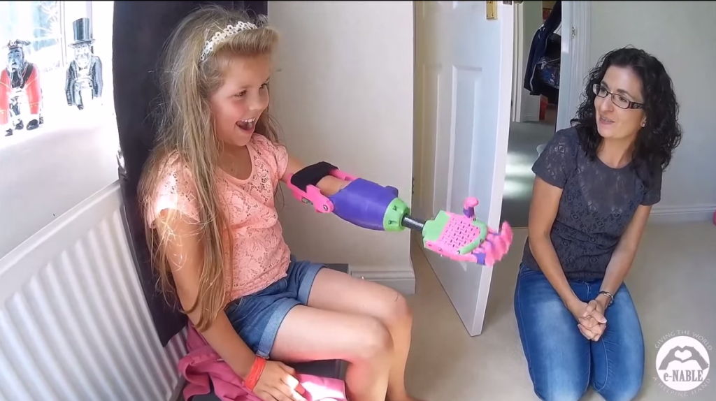 El emotivo video de una pequeña que recibe una prótesis en 3D