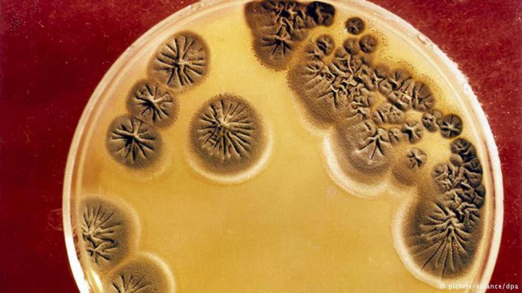 EE.UU.: mujer muere por bacteria resistente a antibióticos