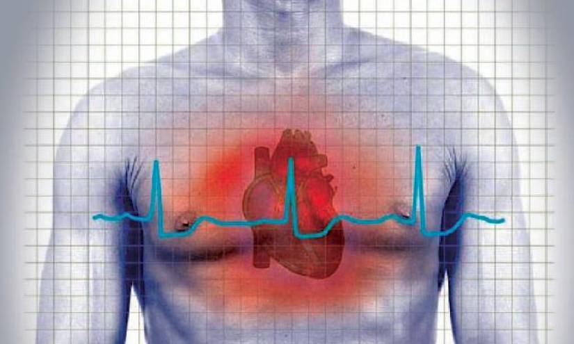Un infarto es un riesgo latente si no se lleva un estilo de vida saludable.