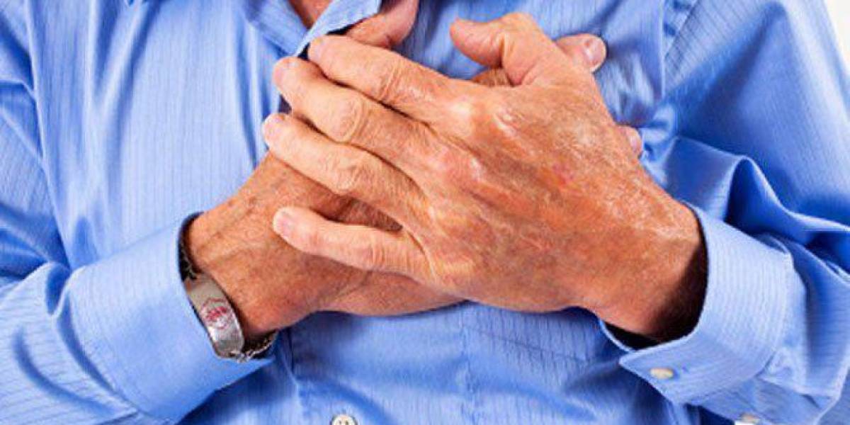 Cinco señales que alertan sobre el riesgo de sufrir un infarto
