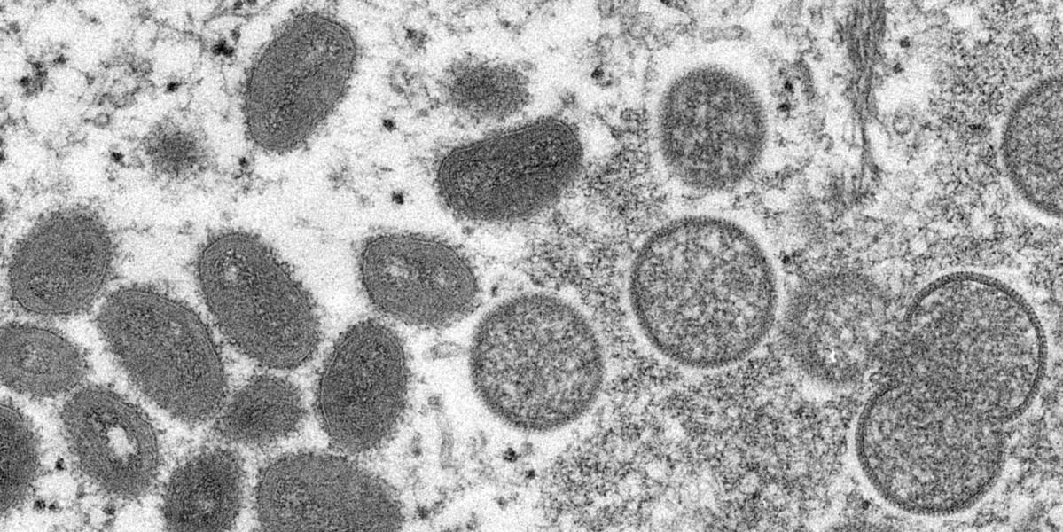Viruela del mono: Países Bajos vacunará a grupos de riesgo; Francia recomienda la inoculación
