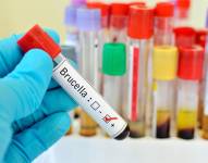 La brucelosis es una enfermedad causada por especies de la bacteria Brucella y provoca síntomas similares al de una gripe.