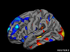 Escáner cerebral para detectar autismo