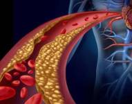 Los investigadores han recordado que la mayor parte del colesterol que las células utilizan proviene de su exterior.