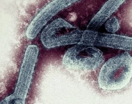 El virus de Marburgo se detectó por primera vez en la ciudad de Marburgo, en Alemania, en 1967.