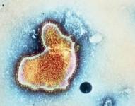 Imagen del Virus Respiratorio Sincitial o VRS. Sincitial se refiere a que el virus destruye membranas celulares por lo que se forman masas con numerosos núcleos celulares llamadas sincicios.