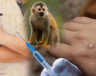 El Ministerio de Salud Pública confirmó el primer caso de viruela del mono en Ecuador.