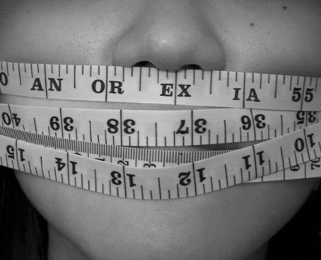 La anorexia, una enfermedad que aniquila al paciente y a su familia