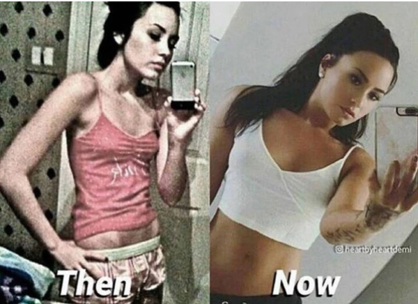 Demi Lovato compartió el antes y después de sufrir trastornos alimenticios