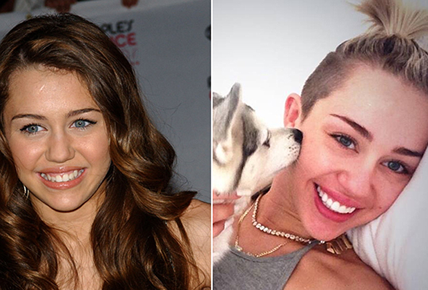 El antes y después de las dentaduras de los famosos