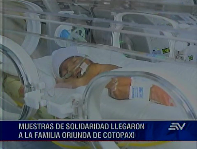Cuatrillizos nacidos en Quito mejoran satisfactoriamente