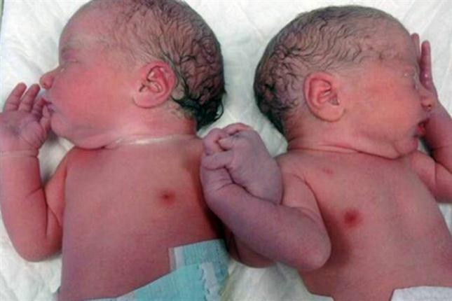 Emotiva foto de mellizos tomados de la mano al nacer