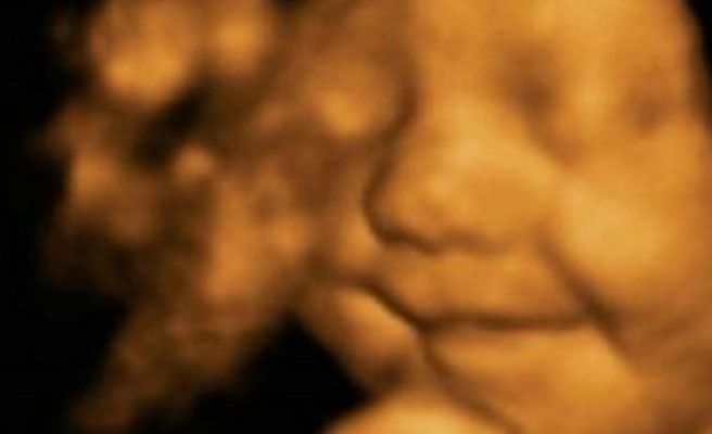 Una ecografía en 4D capta la sonrisa del bebé más feliz del mundo