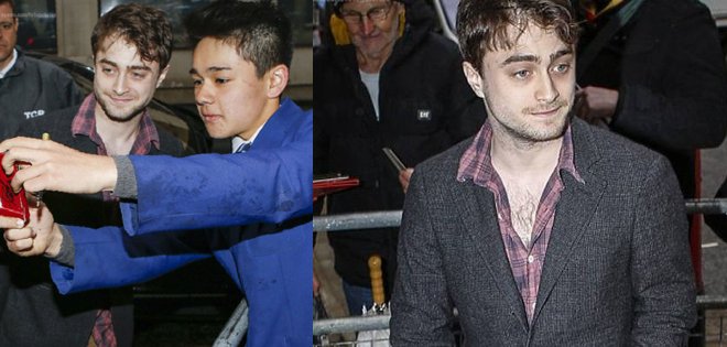 El ex Harry Potter preocupa por su enfermizo aspecto