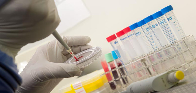 Inician primeros ensayos clínicos de posibles tratamientos contra el ébola