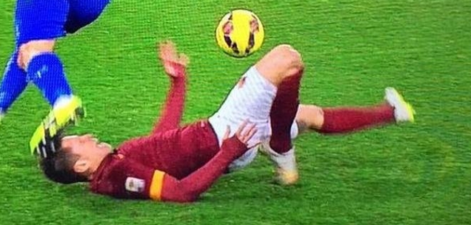(VIDEO) La dolora e impactante lesión de un jugador del Roma