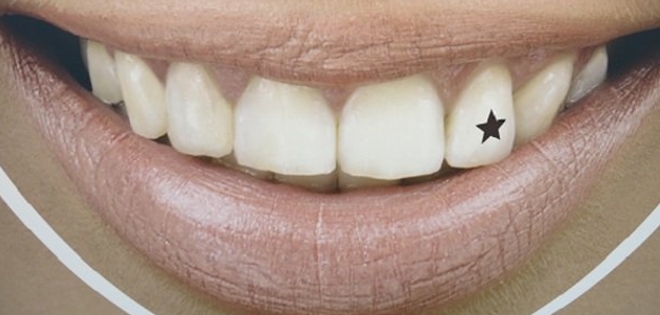La nueva y peligrosa moda de tatuarse en los dientes