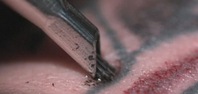 Desarrollan crema capaz de borrar tatuajes sin dolor