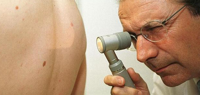 El dolor y el picor en lesiones cutáneas pueden ser una señal de alarma para el cáncer de piel