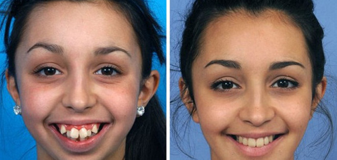 Joven experimenta increíble transformación gracias a cirugía facial