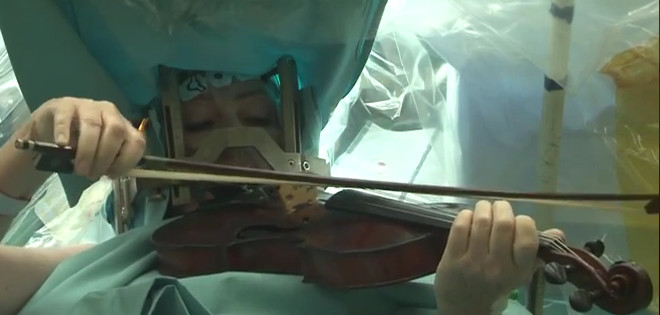 Una mujer toca violín durante su cirugía de cerebro