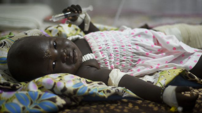 Bebé que sobrevivió milagrosamente a accidente aéreo en Sudán del Sur está consciente