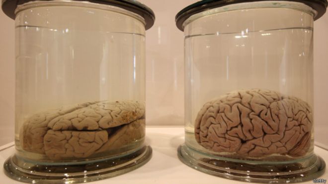 Desaparecen 100 cerebros conservados en universidad estadounidense