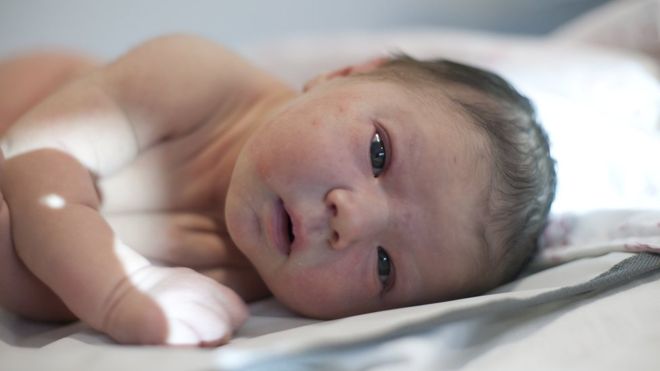 Por qué puede ser peligrosa la moda de untar flora vaginal a los bebés recién nacidos por cesárea