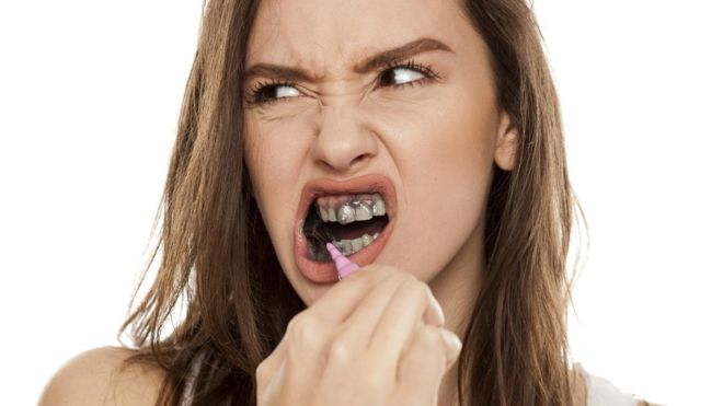 El peligro de blanquear los dientes con pasta de carbón