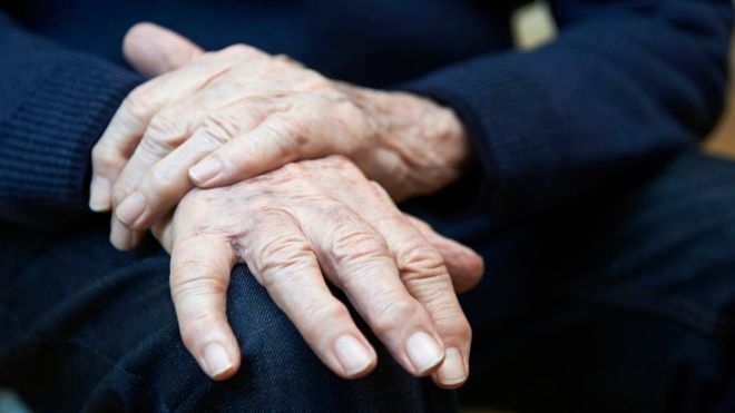4 síntomas que indican que tienes más probabilidades de padecer Parkinson