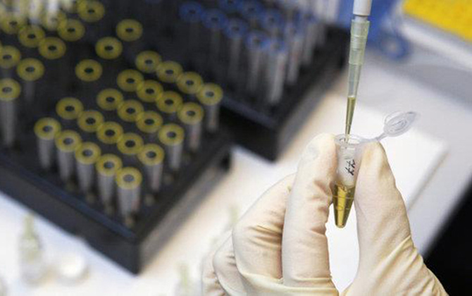 Comienzan los ensayos para una vacuna contra el ébola en Suiza
