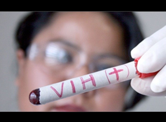 Aparente cura de sida tras integración de virus en el ADN