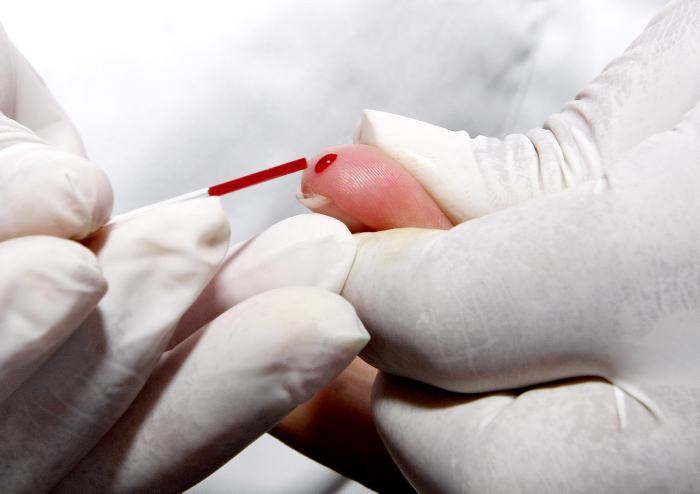 Ecuador registra 3.294 nuevos casos de VIH, según el Ministerio de Salud