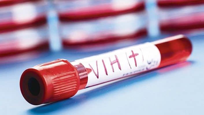 El nuevo tratamiento que podría eliminar el virus del VIH por completo