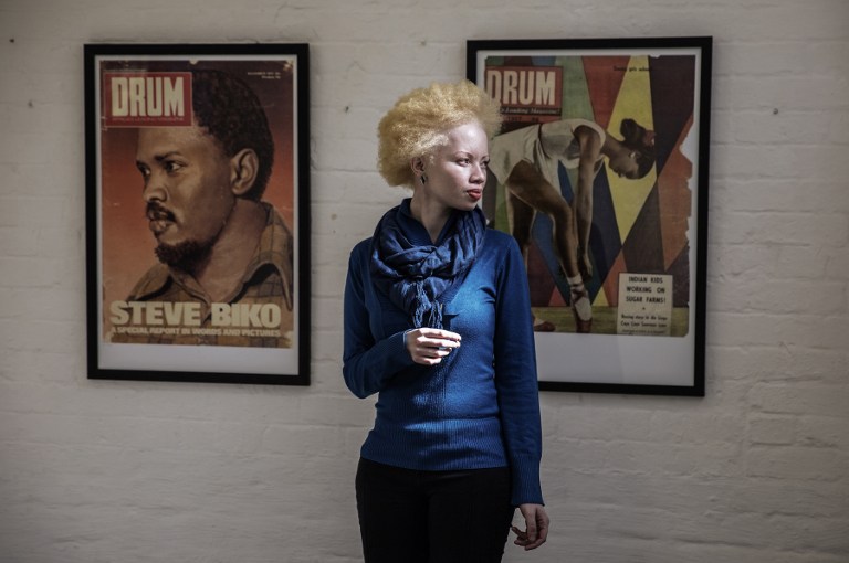 Thando Hopa, la lucha de la modelo albina suráfricana