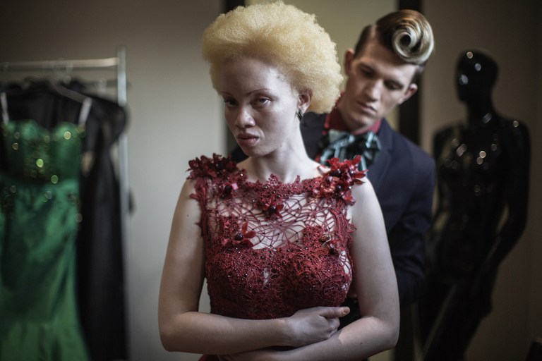 Thando Hopa, la lucha de la modelo albina suráfricana