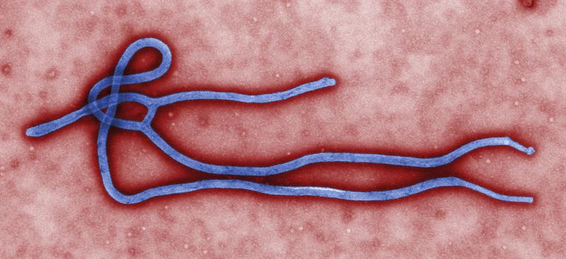 Pruebas de laboratorio descartan caso de ébola en Canadá