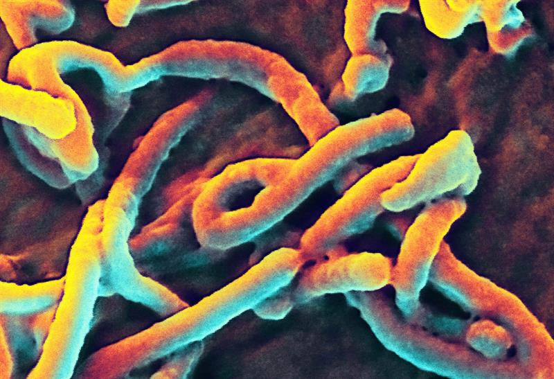 Una vacuna contra el ébola logra inmunizar a primates a largo plazo