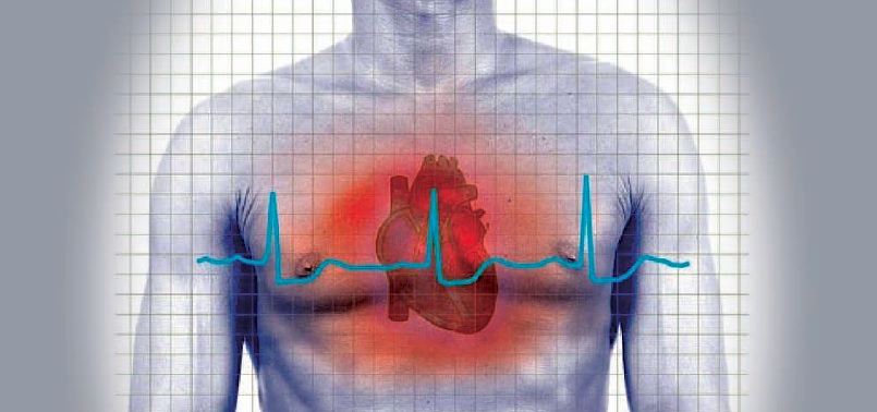 Diferencias entre paro cardíaco y muerte cardíaca súbita