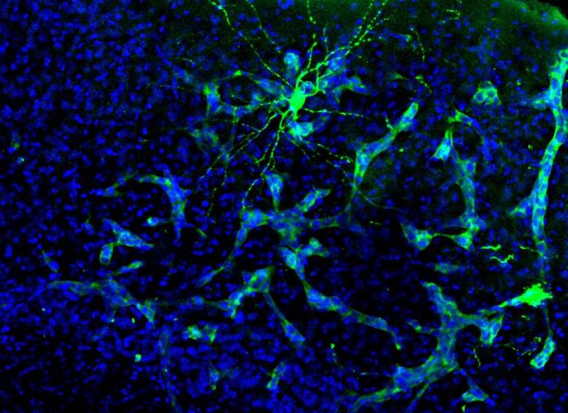 Metástasis en cerebro de ratón. Se aprecia cómo la metástasis (verde más claro) interacciona con una neurona (verde más intenso). Esta neurona está marcada específicamente para su estudio, pero la metástasis está interaccionando con muchas más