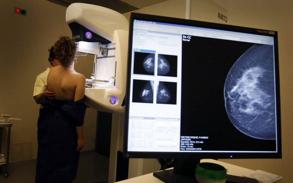 Combinación de terapias reduce recurrencia de cáncer de mama