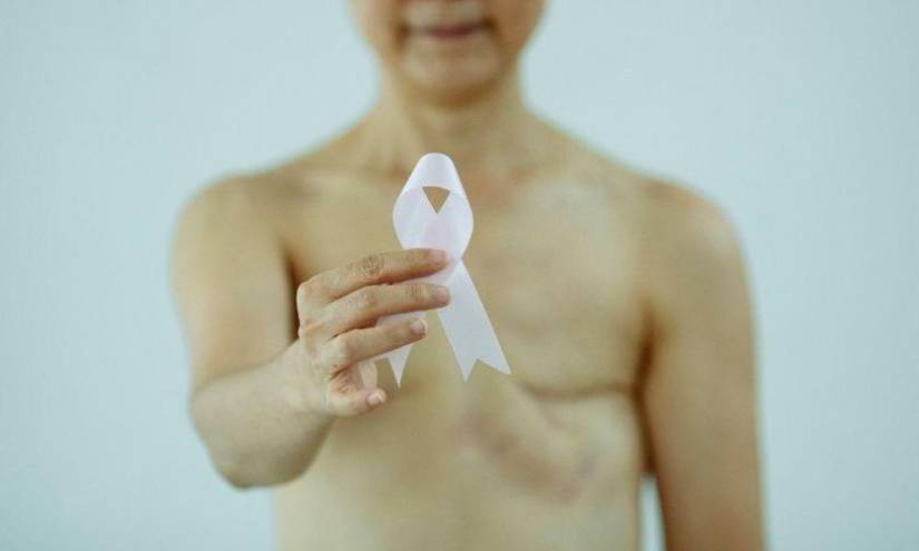 En 2020, alrededor de 685.000 mujeres en todo el mundo fallecieron como consecuencia del cáncer de mama.