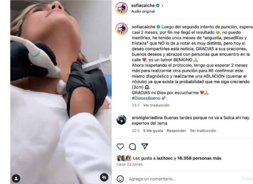 En la reciente publicación de la actriz, compartió con sus seguidores que tiene un tumor benigno que está siendo tratado