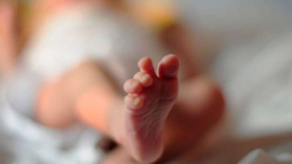Conmoción en Argentina por nacimiento de bebé con 2 cabezas