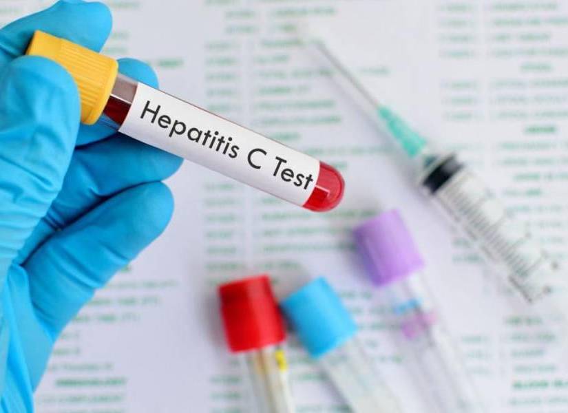 Padecer hepatitis C es un importante factor de riesgo del cáncer de hígado.