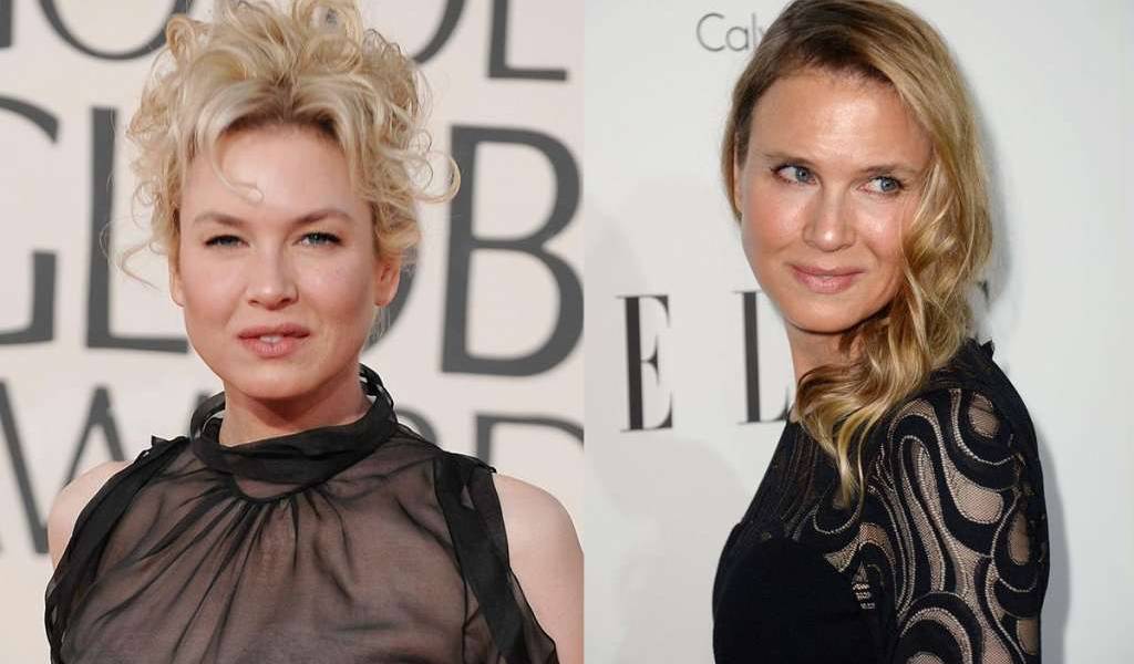 Renée Zellweger se pronuncia sobre la criticada foto de su rostro en 2014