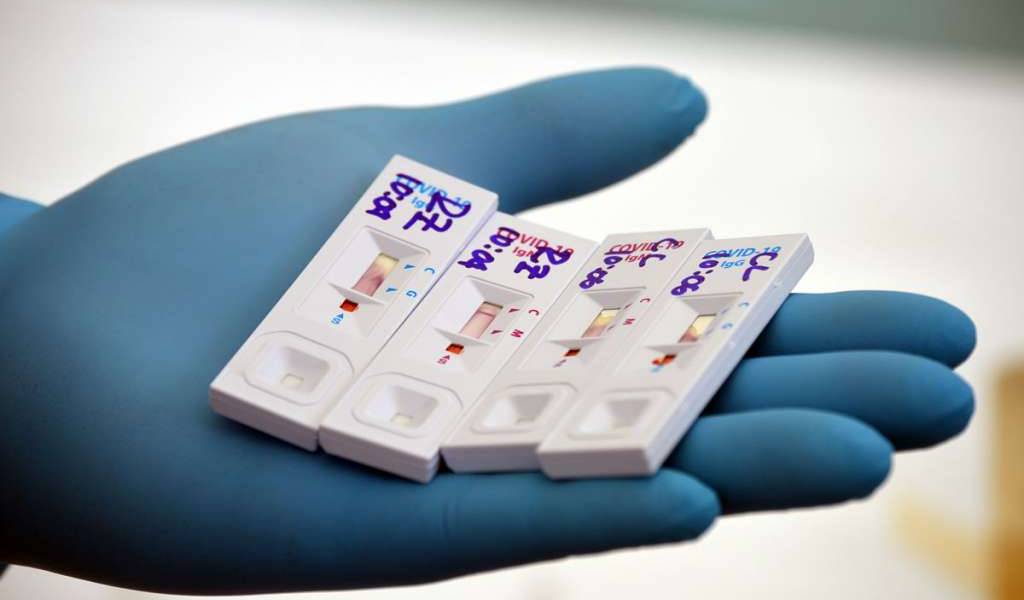 Sube demanda de pruebas de COVID en medio de indisciplina