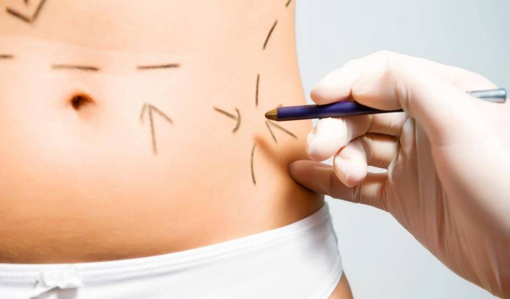 Someterse a una cirugía estética siempre implica riesgos