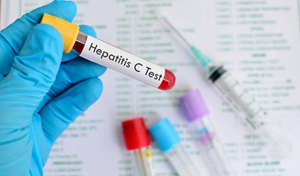 La OMS advierte que 325 millones de personas padecen hepatitis