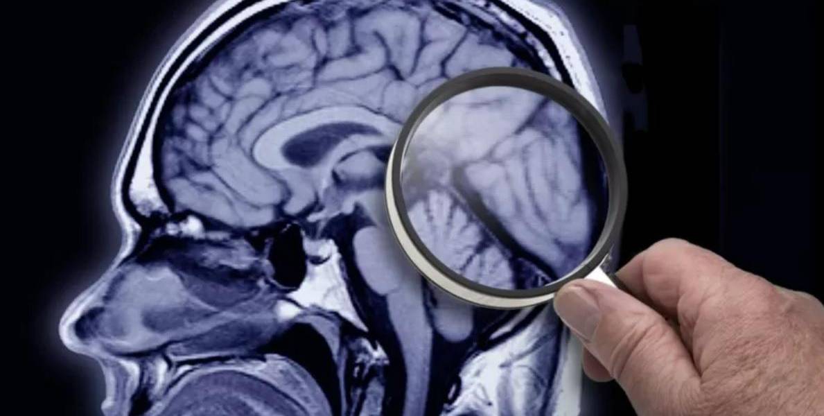 Por qué los humanos hace 3.000 años tenían el cerebro más grande que el nuestro